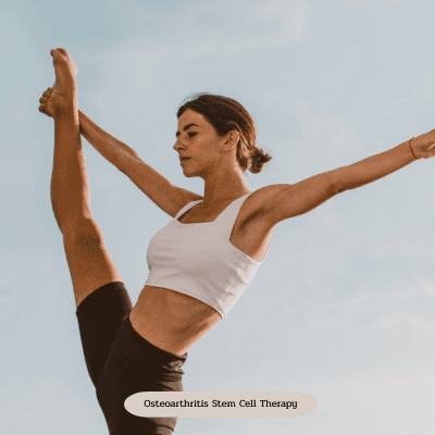 Service Osteoarthritis Stem Cell Therapy Image