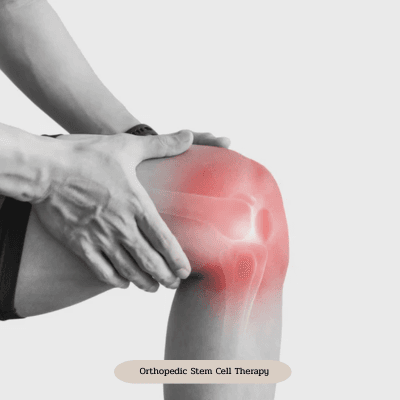 Service Orthopedic Stem Cell Therapy Image