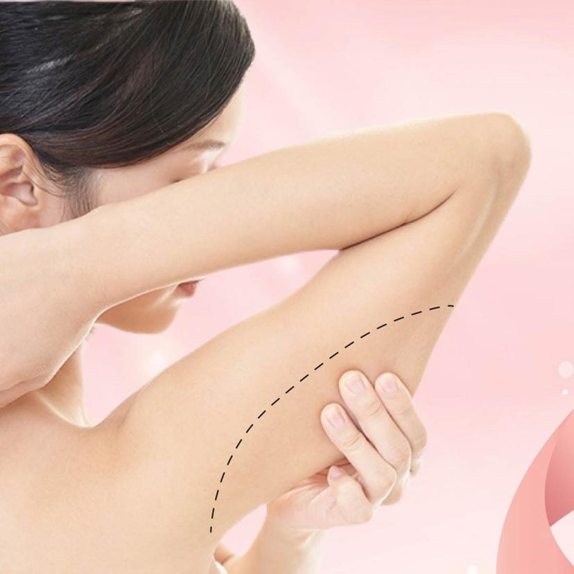 Service Arm Liposuction Image