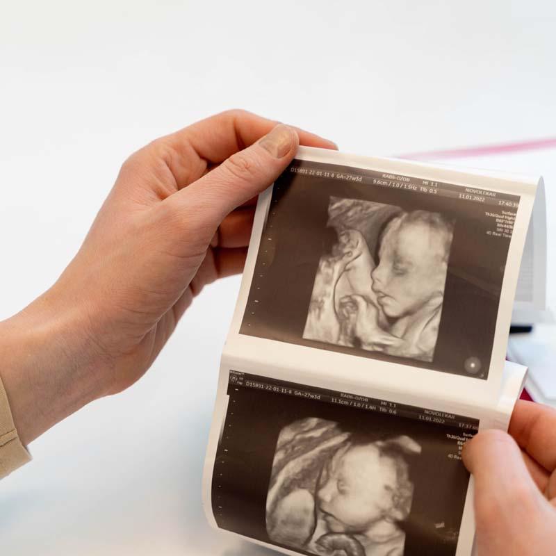Service 4D Ultrasonography Image