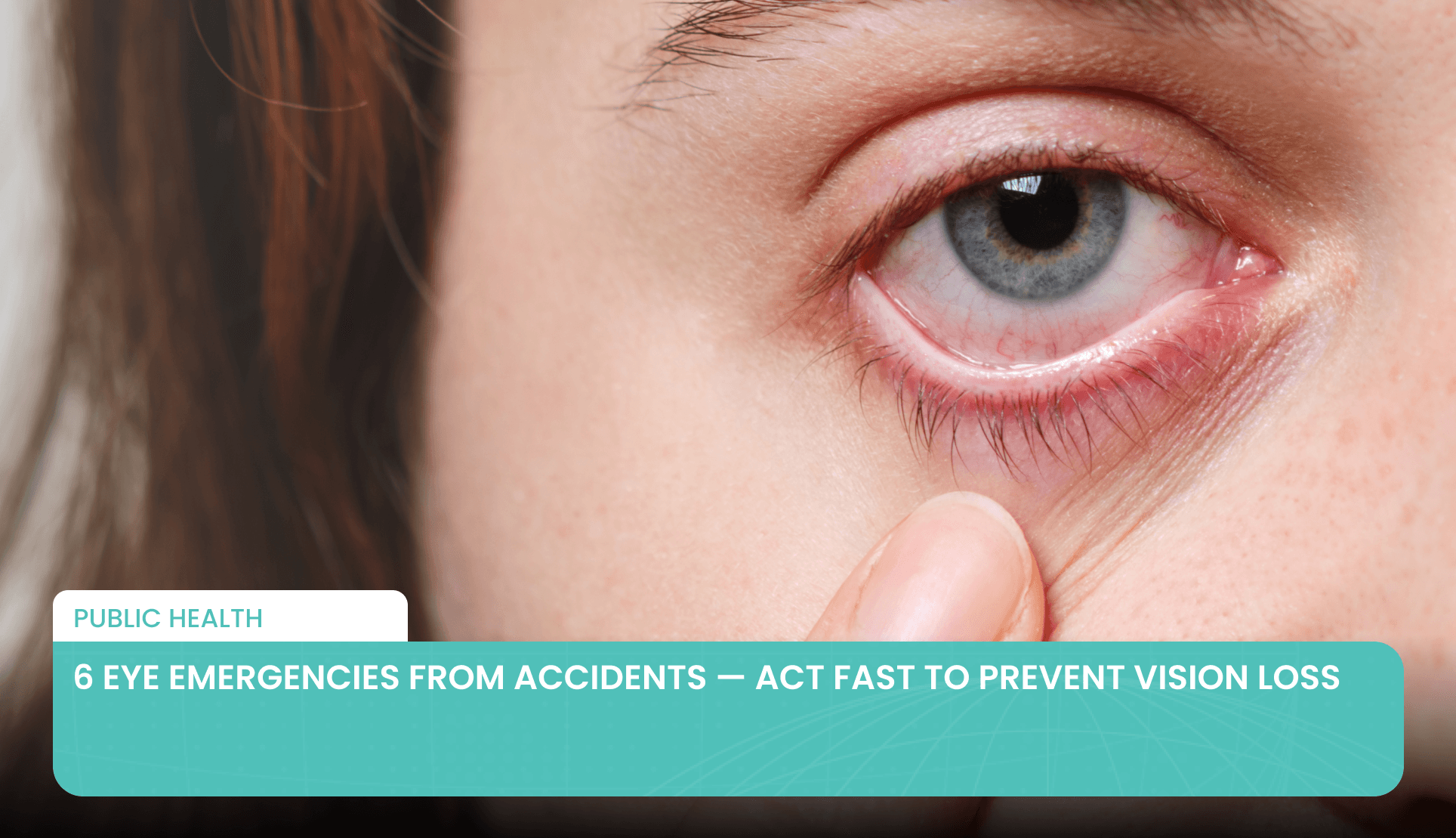6 Eye Emergencies from Accidents — Act Fast to Prevent Vision Loss's featured image