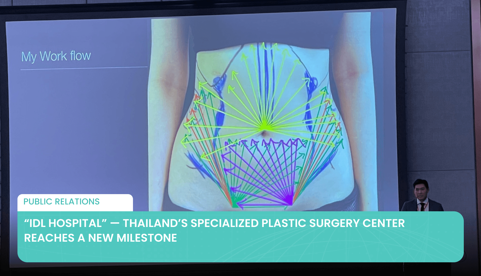 “IDL Hospital” — Thailand’s Specialized Plastic Surgery Center Reaches a New Milestone's featured image
