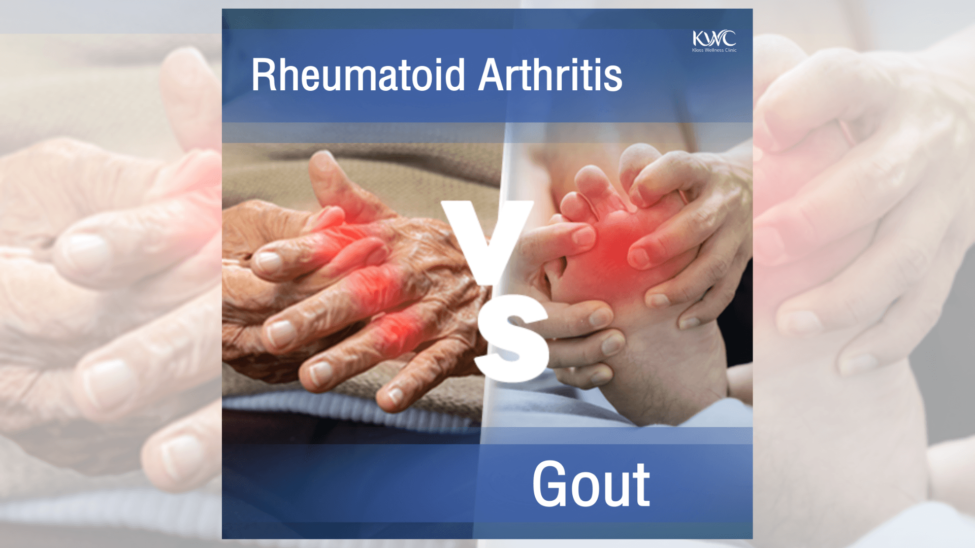 Blog: Gout and Rheumatoid Arthritis  Did you know they’re different?
