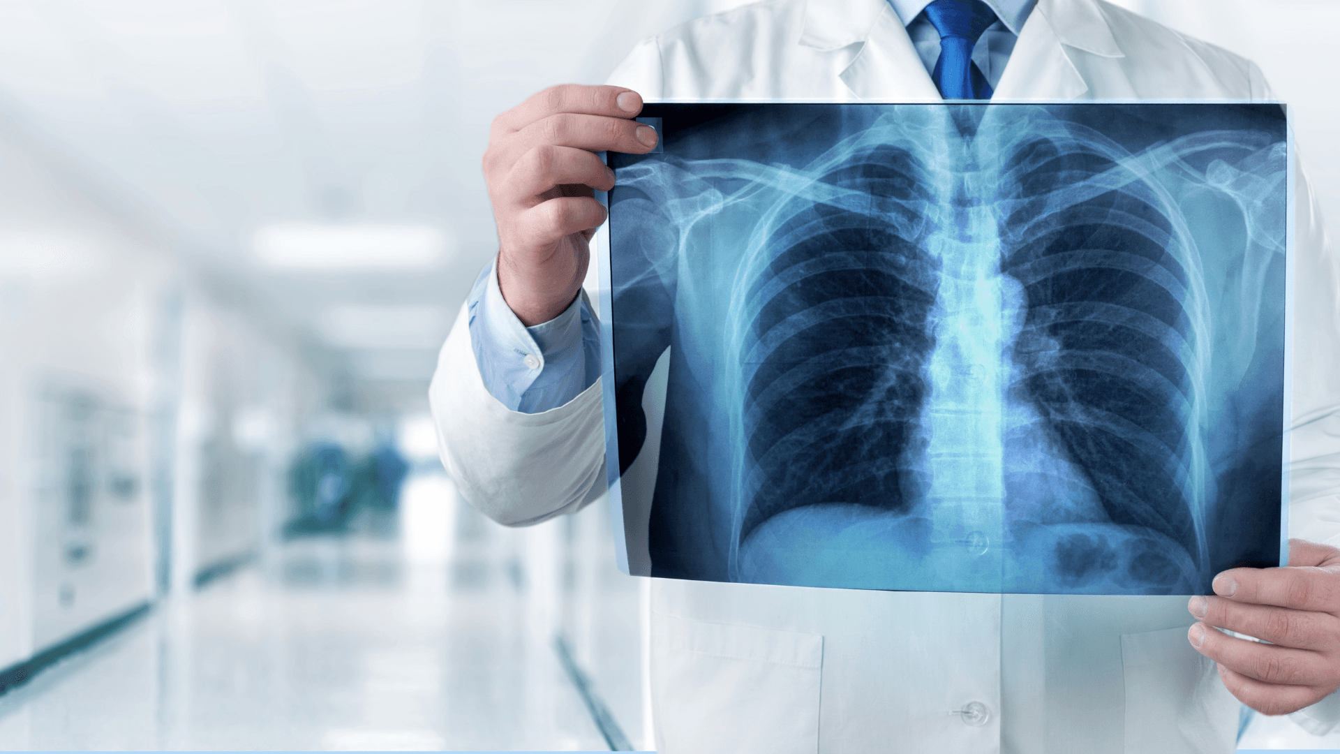 5 Treatments to Stop Lung Cancer Before It Spreads's featured image