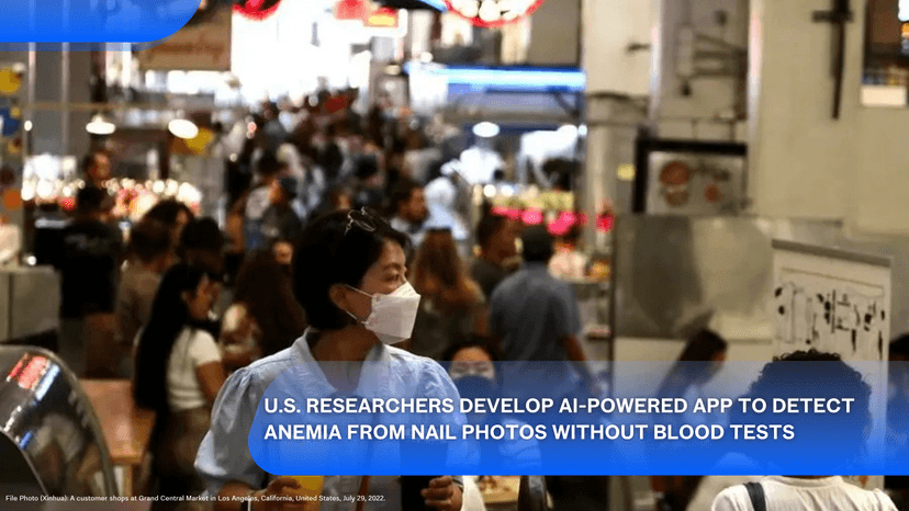 Logo for News - U.S. Researchers Develop AI-Powered App to Detect Anemia from Nail Photos Without Blood Tests