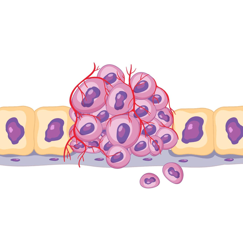 Service A Cancer-Free Tomorrow with Tumor Vaccines Image