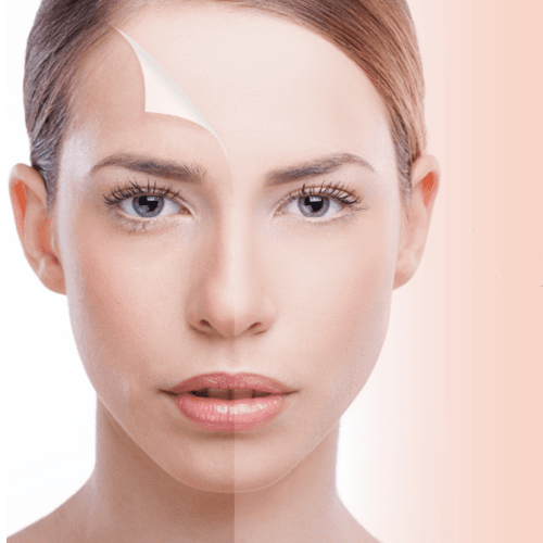 Service Advanced IPL (Intense Pulsed Light) Image