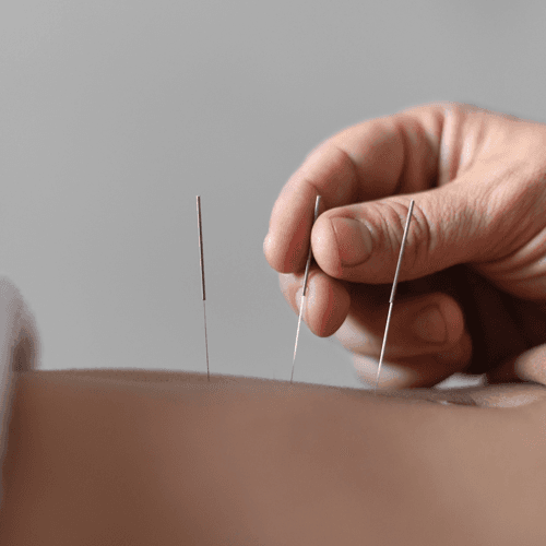 Service Elevate Your Well-being with Hydro-acupuncture Image