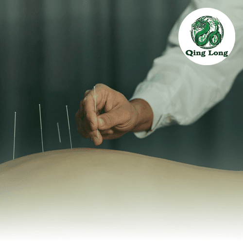 Service Acupuncture for back pain relief Therapy Image