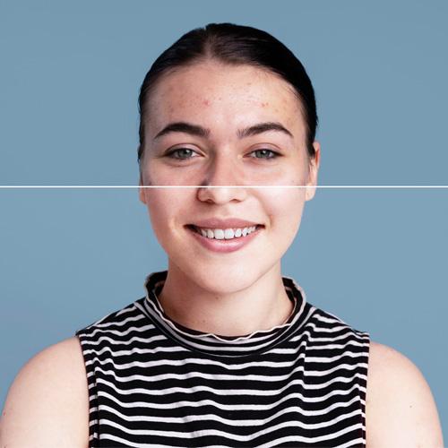 Service Ultherapy and Thermage Image