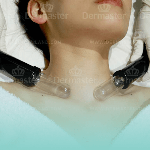 Service Lymphatic Drainage Image