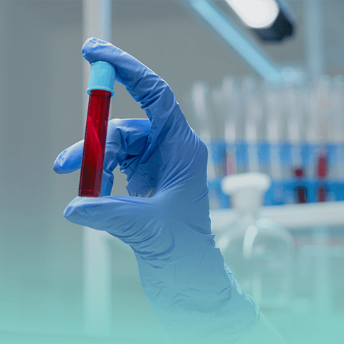 Service Insight into Your Health with Live Blood Analysis Image