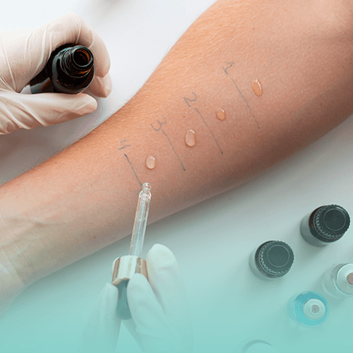 Service Uncover Hidden Allergies with our Allergy Test and Food Intolerance Program Image