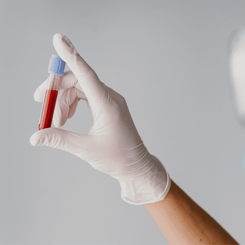 Service Discover Your Allergies and Improve Your Quality of Life with an IgE Blood Test Image