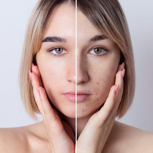 Service The Melasma & Dark Spot Clear Program Image