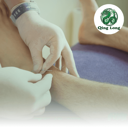 Service Relief with Acupuncture: Your Solution for Osteoarthritis and Leg Pain Image