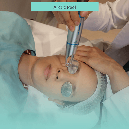 Service Transform Your Skin with Arctic Peel: Micro Laser Peel for Acne Scars and Skin Rejuvenation Image