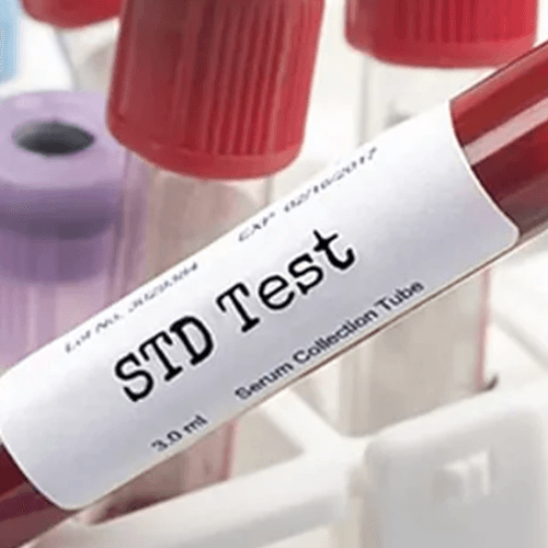 Service Sexually Transmitted Disease (STD) / Sexually Transmitted Infection (STI) Test and HIV Image