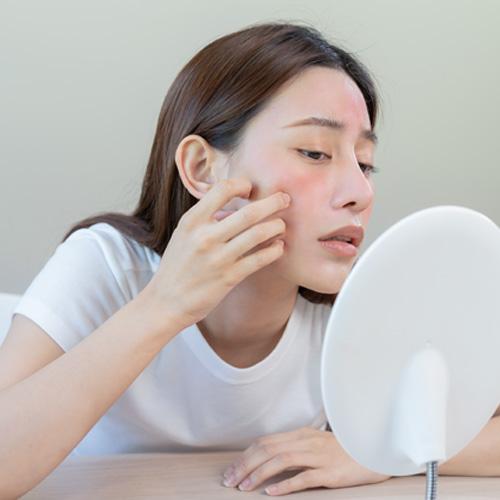 Service Wrinkle Reduction with Toxin Image