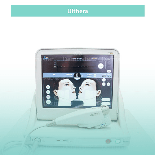 Service Ultherapy Image