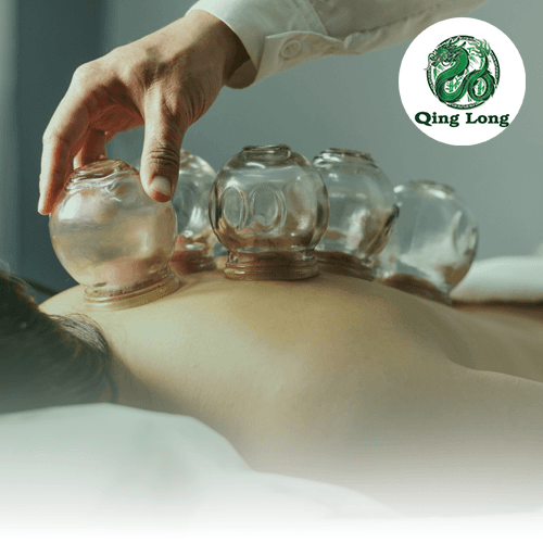 Service Discover the Healing Art of Cupping Therapy Image