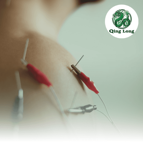 Service Enhance Your Acupuncture Experience with Electrical Stimulation Image
