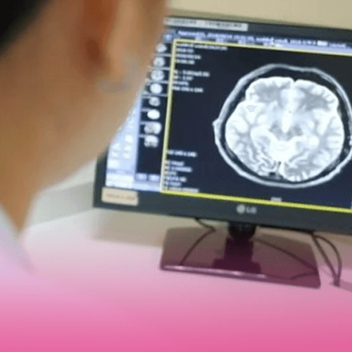 Service Department of Nervous System and Brain Image