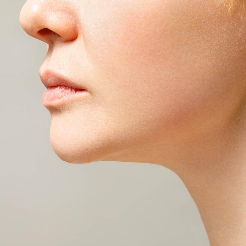 Service Chin Augmentation Image