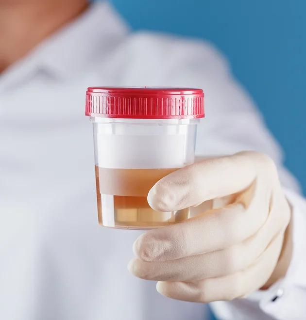 Service GUT HEALTH BALANCE TEST Image