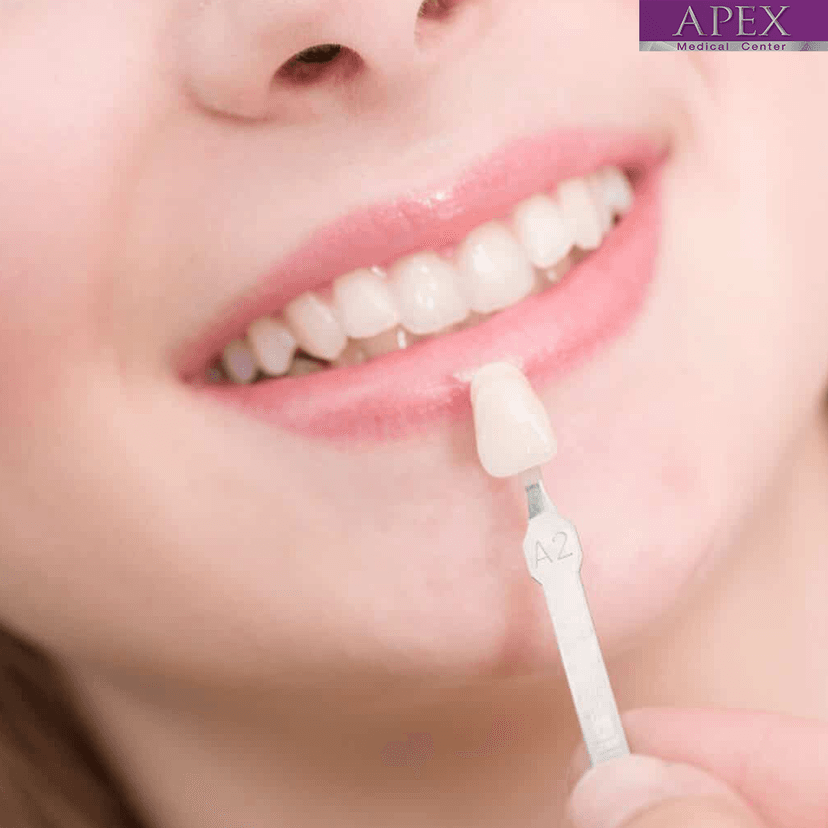 Service HOLLYWOOD SMILE: Transform Damaged Teeth into a Radiant Smile Image