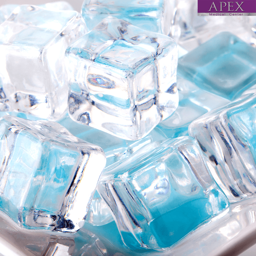 Service ICE Lab: Cutting-Edge Cryotherapy at -110°C Image