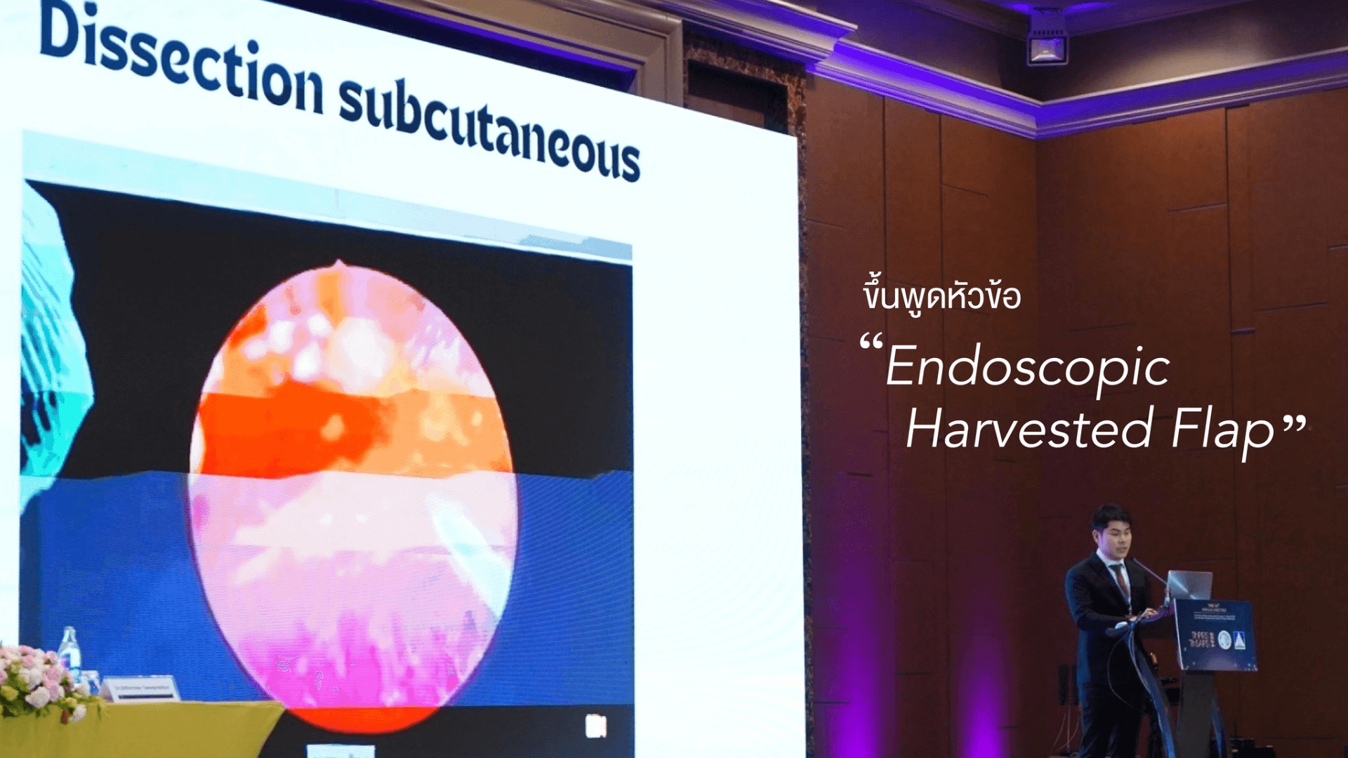 Dr.Bhakabhob of IDL Hospital Presents at ThPRS and ThSAPPS 2024 on Endoscopic Harvested Flap's featured image