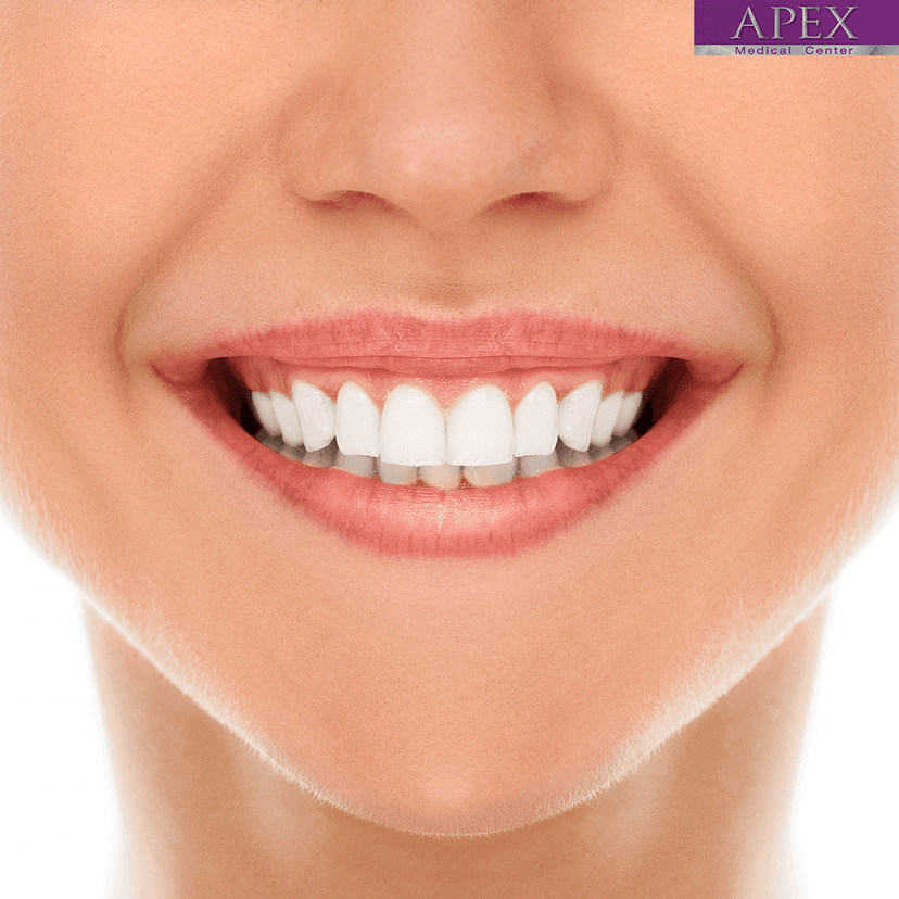 Service Repair Chipped, Cracked, or Gapped Teeth with Cosmetic Dental Veneers Image