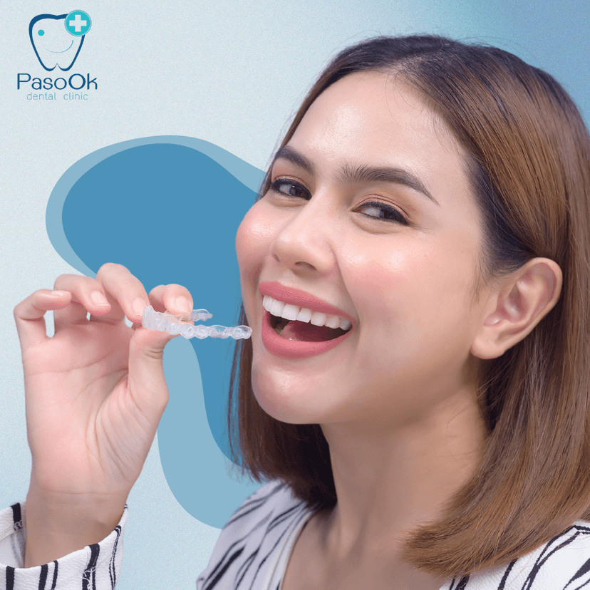 Service Invisalign Clear Aligners Image