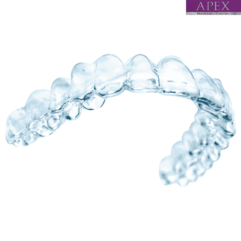 Service Invisalign: The Clear Choice for Teeth Straightening Image