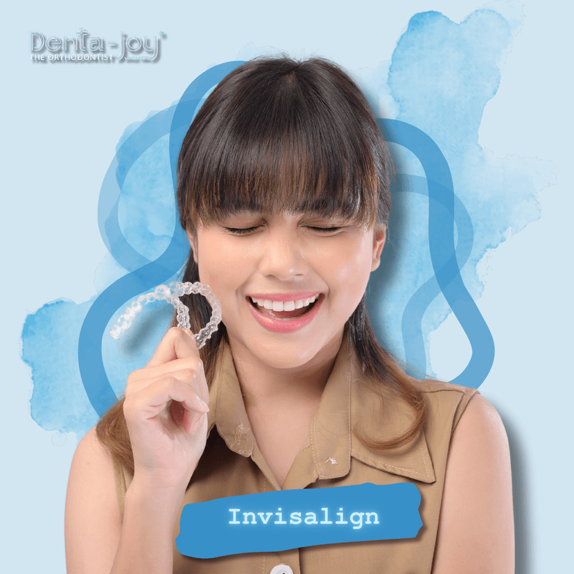 Service Invisalign Image