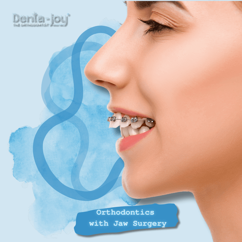 Service Orthodontics with Jaw Surgery Image