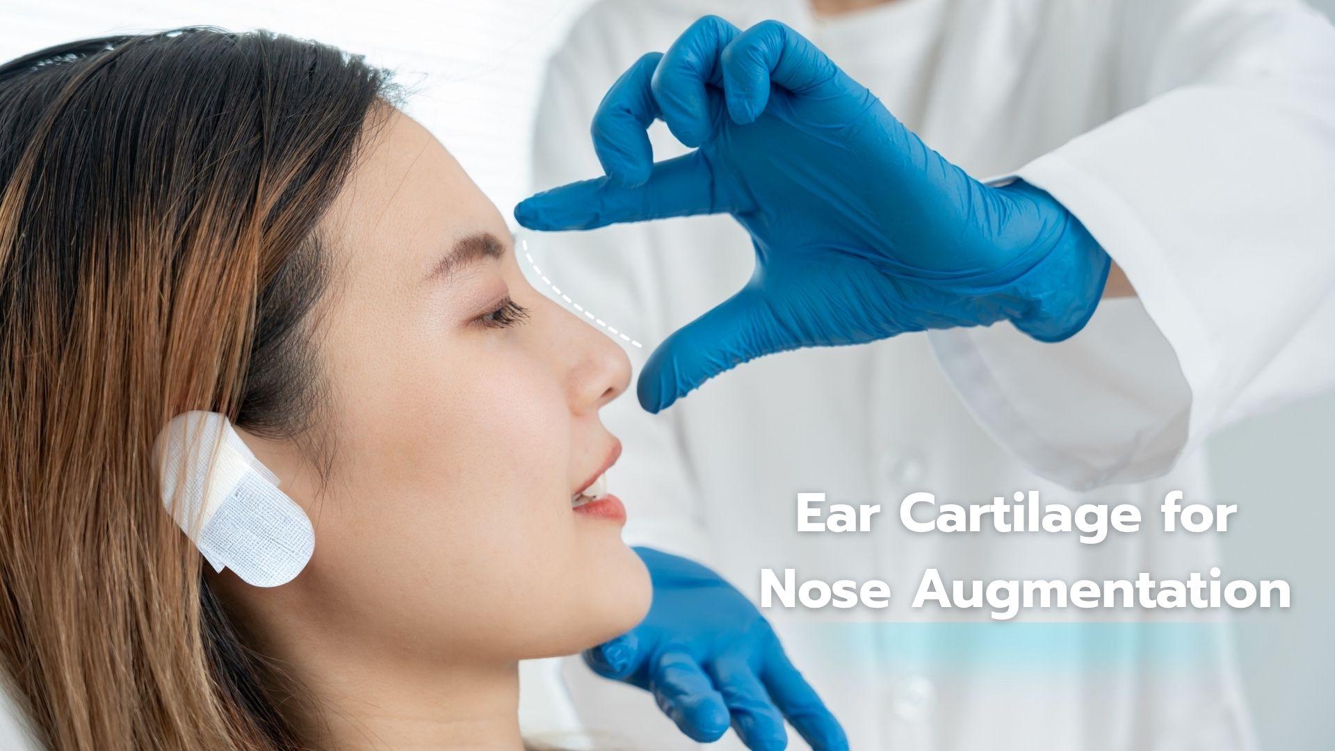 Blog: Can You Use Someone Else’s Ear Cartilage for Nose Augmentation?