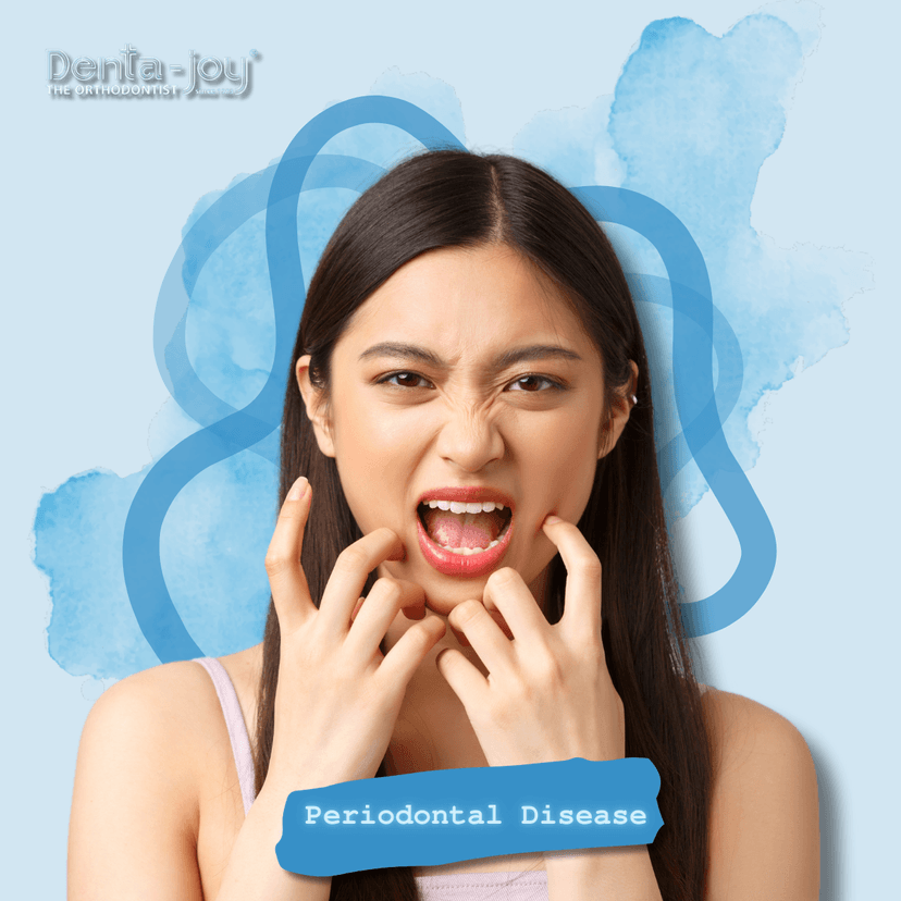 Service Periodontal Disease Image