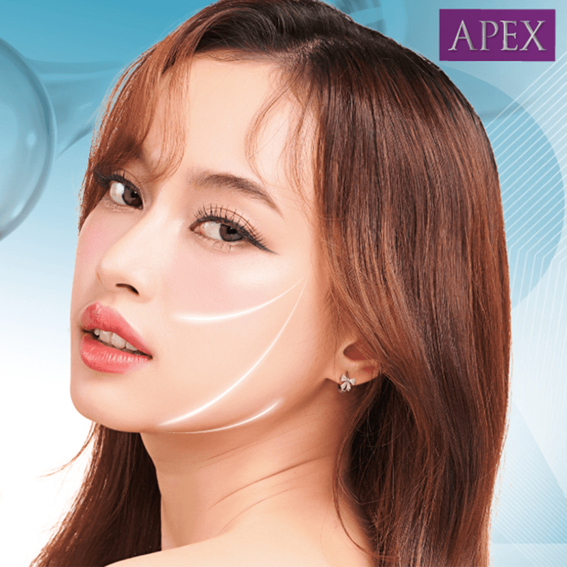 Service Radiesse Plus: The Revolutionary Regenerative Biostimulator Image
