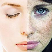 Service SKIN PIGMENTATION Image