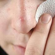 Service SKIN PORES ​​​​​​​ Image