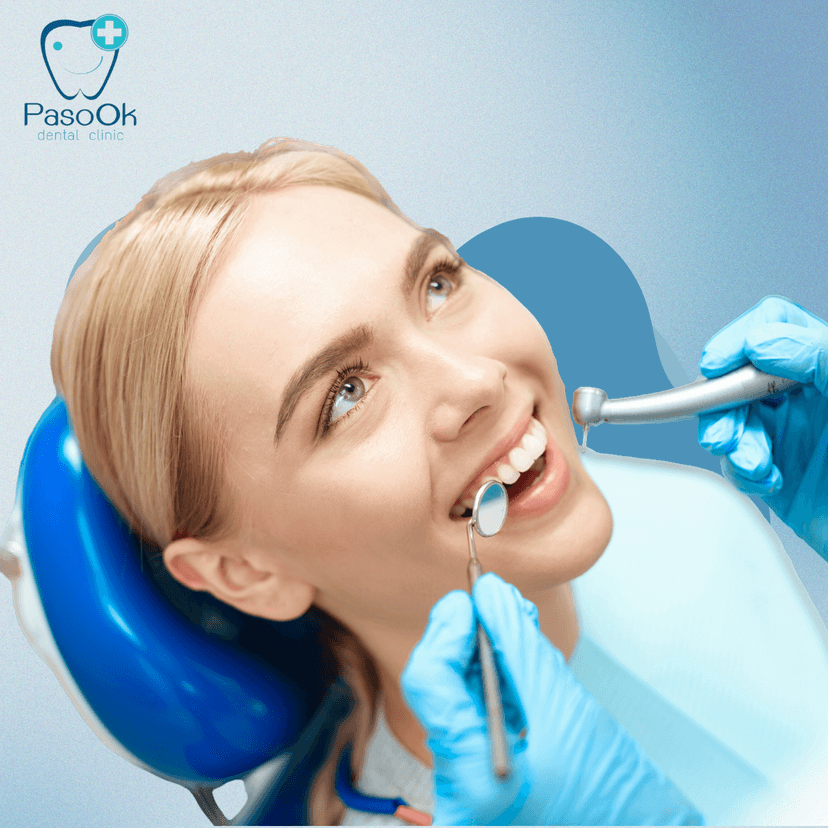 Service Teeth Scaling and Cleaning Image