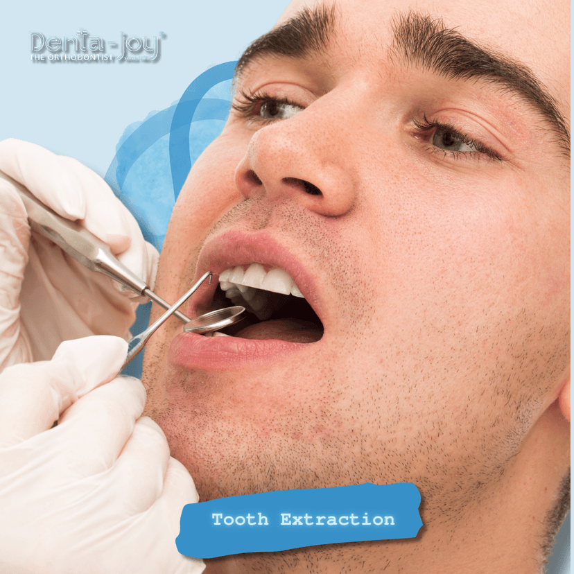 Service Tooth Extraction Image