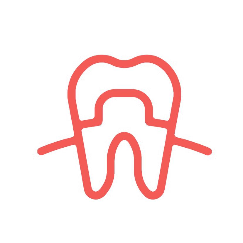 Service Crowning Achievement: Restoring Strength and Beauty to Your Smile ​​​​​​​ Image