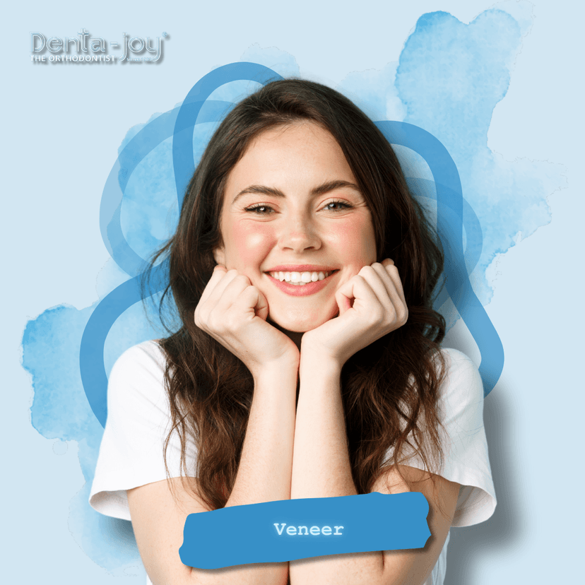 Service Veneer Image