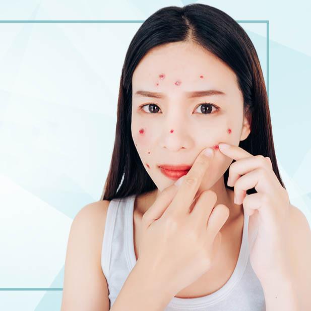 Service Acne Clear Image