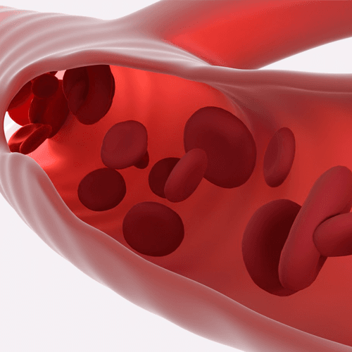 Service Vascular Surgery: Advanced Care for Vascular Health Image