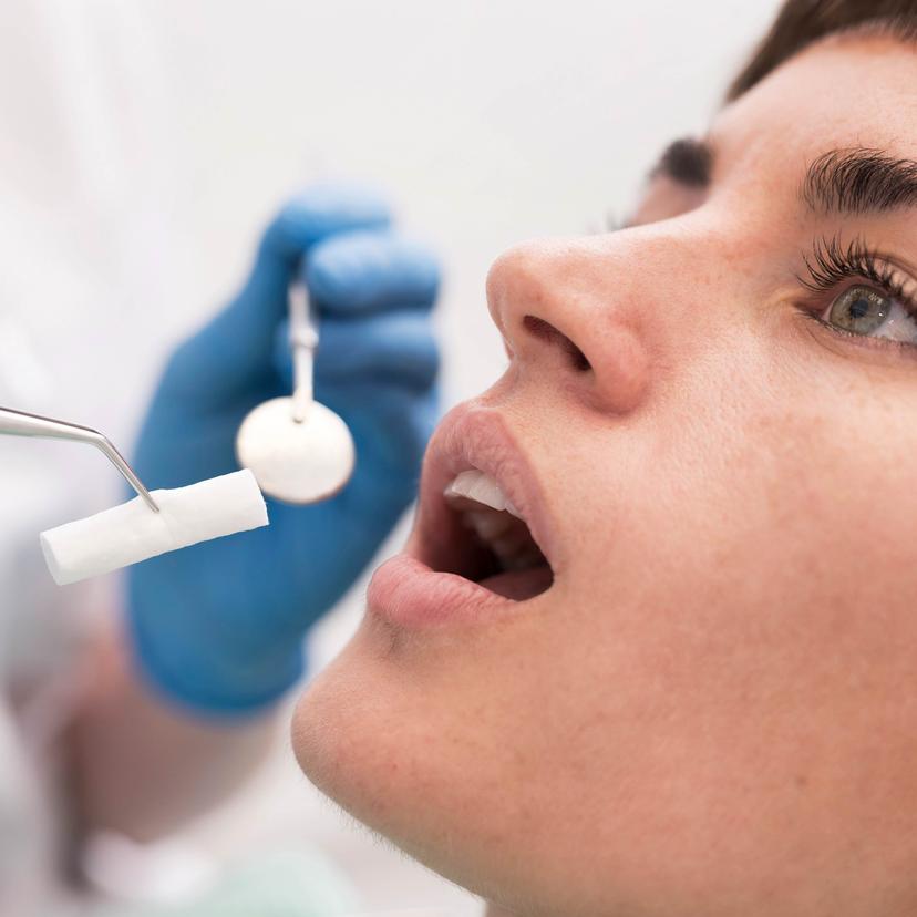 Service Dental Fillings: Restoring Your Smile and Oral Health Image