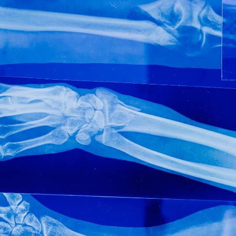 Service Hand and Wrist Clinic Image